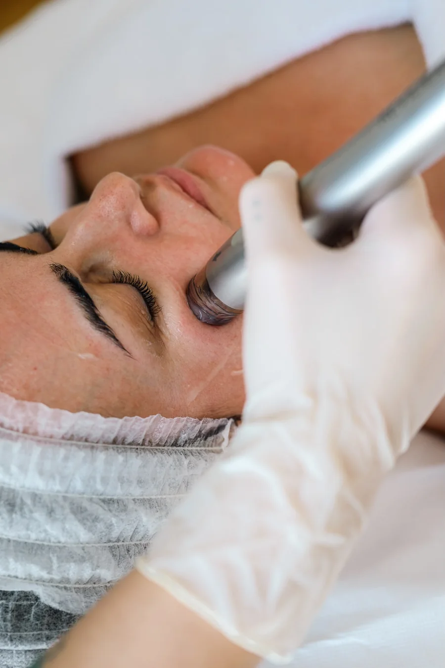 Reviderm cellJET