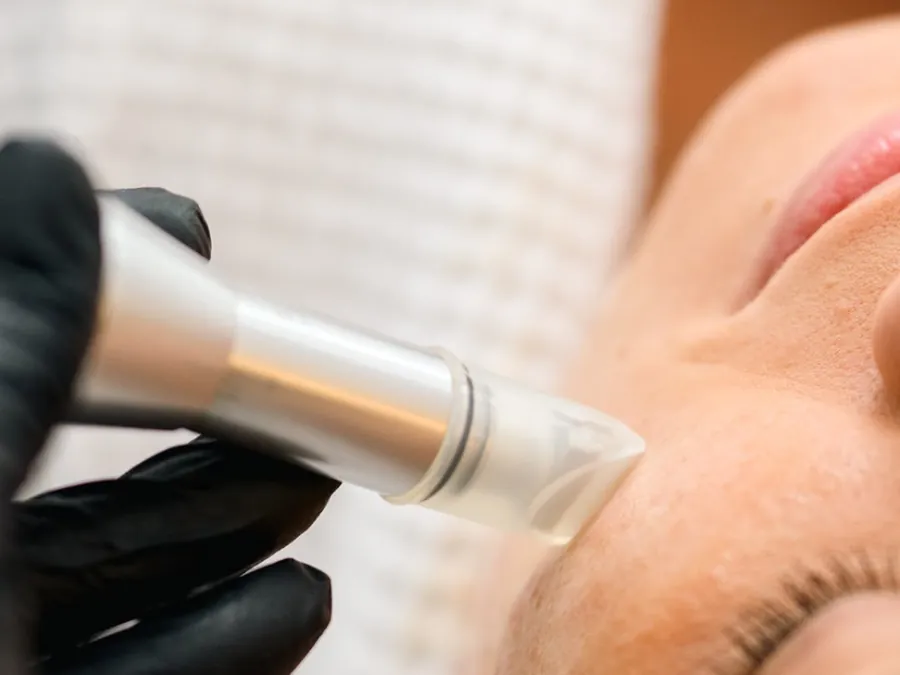 Microneedling Skin Needler